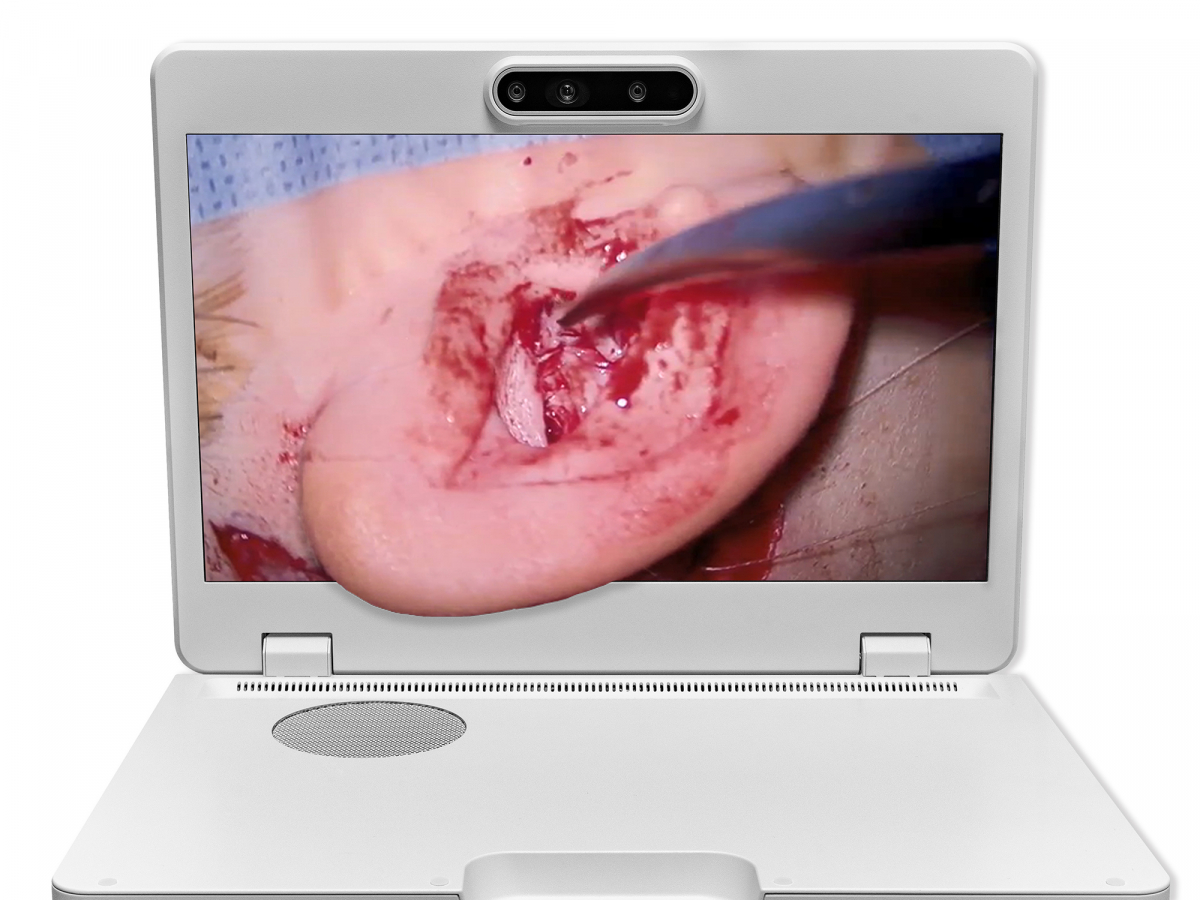 达擎之＂Heads-up 3D显微手术显示系统＂，整合4K裸眼3D显示及眼球追踪系统，具备快速追踪人眼移动位置功能，减轻医师长时间维持固定姿势的负担，让医师能有更宽广清晰的3D立体视野及更舒适的姿势来执行手术。